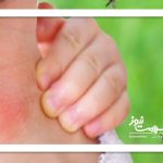 بهترین راهکار برای دفع پشه