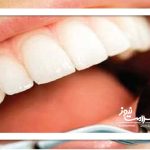 تأثیر استرس بر دهان و دندان