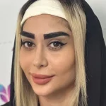 کاشت ابرو بدون جراحی و هزینه آن در کلینیک لاله