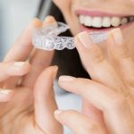 مرتب کردن دندان بدون ارتودنسی