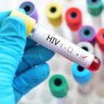 روند افزایشی موارد ابتلا به HIV در مشهد / هشدار درباره شیوع در گروه سنی جوان و میانسال