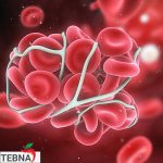 هموفیلی را بیشتر بشناسیم، از علائم تا کنترل بیماری
