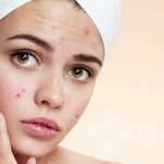 آیا قرص آسپرین برای پوست خوب است؟